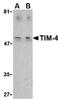 T Cell Immunoglobulin And Mucin Domain Containing 4 antibody, AP05602PU-N, Origene, Western Blot image 