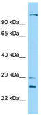 Dynein Axonemal Heavy Chain 12 antibody, TA331560, Origene, Western Blot image 