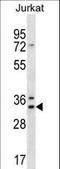 DnaJ Heat Shock Protein Family (Hsp40) Member C9 antibody, LS-C167480, Lifespan Biosciences, Western Blot image 