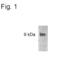 S100 Calcium Binding Protein A8 antibody, PA1-4177, Invitrogen Antibodies, Western Blot image 