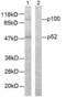 Nuclear Factor Kappa B Subunit 2 antibody, LS-C118193, Lifespan Biosciences, Western Blot image 