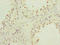 Peptidase, Mitochondrial Processing Beta Subunit antibody, LS-C676284, Lifespan Biosciences, Immunohistochemistry paraffin image 
