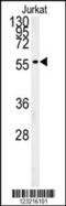 Perilipin 2 antibody, 61-797, ProSci, Western Blot image 