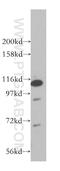 Kinesin Family Member 3C antibody, 14333-1-AP, Proteintech Group, Western Blot image 
