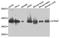 Serine/Threonine Kinase Receptor Associated Protein antibody, A5964, ABclonal Technology, Western Blot image 