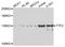 Forkhead Box E1 antibody, A04344, Boster Biological Technology, Western Blot image 