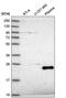 TATA-Box Binding Protein Associated Factor 11 antibody, PA5-65545, Invitrogen Antibodies, Western Blot image 