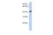 Transcriptional Adaptor 1 antibody, GTX45773, GeneTex, Western Blot image 