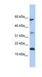 Lipocalin 6 antibody, NBP1-57957, Novus Biologicals, Western Blot image 