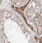 Ankyrin Repeat Domain 13B antibody, FNab00407, FineTest, Immunohistochemistry paraffin image 