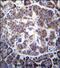 Transducin beta-like protein 2 antibody, PA5-71756, Invitrogen Antibodies, Immunohistochemistry paraffin image 