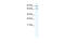 Metastasis Associated 1 Family Member 2 antibody, 28-626, ProSci, Enzyme Linked Immunosorbent Assay image 