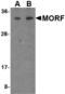 CSR antibody, A30172, Boster Biological Technology, Western Blot image 