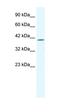 ETS Transcription Factor ELK4 antibody, orb324532, Biorbyt, Western Blot image 