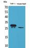 Triggering Receptor Expressed On Myeloid Cells 1 antibody, A02135, Boster Biological Technology, Western Blot image 