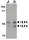 Kruppel Like Factor 4 antibody, PA5-20897, Invitrogen Antibodies, Western Blot image 