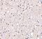 BR Serine/Threonine Kinase 2 antibody, A05321, Boster Biological Technology, Immunohistochemistry frozen image 