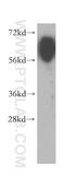 Poliovirus receptor-related protein 3 antibody, 11213-1-AP, Proteintech Group, Western Blot image 