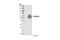 Thymidine Phosphorylase antibody, 2937S, Cell Signaling Technology, Western Blot image 