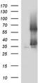 Secretory Carrier Membrane Protein 2 antibody, NBP2-45688, Novus Biologicals, Western Blot image 