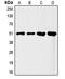 Friend leukemia integration 1 transcription factor antibody, MBS821162, MyBioSource, Western Blot image 