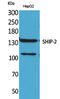 Inositol Polyphosphate Phosphatase Like 1 antibody, A01790-1, Boster Biological Technology, Western Blot image 