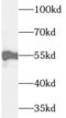 Uridine Monophosphate Synthetase antibody, FNab09253, FineTest, Western Blot image 