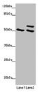 Tubulin Beta 4A Class IVa antibody, CSB-PA025324LA01HU, Cusabio, Western Blot image 