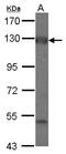 Adenylate Cyclase 2 antibody, LS-C155582, Lifespan Biosciences, Western Blot image 