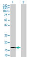 Lipocalin 1 antibody, LS-C197607, Lifespan Biosciences, Western Blot image 