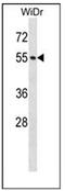 Nucleoporin 50 antibody, AP52974PU-N, Origene, Western Blot image 