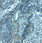 Palmdelphin antibody, A11148, Boster Biological Technology, Immunohistochemistry paraffin image 