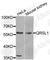 Glutaminyl-TRNA Amidotransferase Subunit QRSL1 antibody, A8499, ABclonal Technology, Western Blot image 