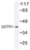 Somatostatin Receptor 1 antibody, AP01431PU-N, Origene, Western Blot image 