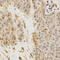 Golgi Associated, Gamma Adaptin Ear Containing, ARF Binding Protein 2 antibody, A04016, Boster Biological Technology, Immunohistochemistry frozen image 