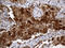 Growth Factor Receptor Bound Protein 7 antibody, LS-C791989, Lifespan Biosciences, Immunohistochemistry paraffin image 