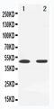 Mitogen-Activated Protein Kinase Kinase 7 antibody, PA5-79627, Invitrogen Antibodies, Western Blot image 