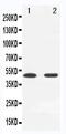 Mitogen-Activated Protein Kinase Kinase 7 antibody, PA5-79627, Invitrogen Antibodies, Western Blot image 