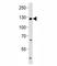 Transient Receptor Potential Cation Channel Subfamily M Member 8 antibody, F41678-0.4ML, NSJ Bioreagents, Immunohistochemistry frozen image 