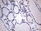 WT1 Associated Protein antibody, LS-C800054, Lifespan Biosciences, Immunohistochemistry paraffin image 