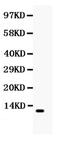 C-C Motif Chemokine Ligand 4 antibody, PA5-78939, Invitrogen Antibodies, Western Blot image 