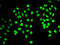 RE1 Silencing Transcription Factor antibody, STJ29241, St John