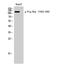 Fibroblast Growth Factor Receptor 1 antibody, A00098Y463, Boster Biological Technology, Western Blot image 