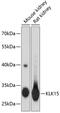 Kallikrein Related Peptidase 15 antibody, GTX66419, GeneTex, Western Blot image 