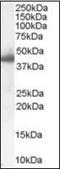 Serpin Family E Member 1 antibody, orb89294, Biorbyt, Western Blot image 
