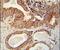 Insulin Like Growth Factor 2 MRNA Binding Protein 1 antibody, PA5-23968, Invitrogen Antibodies, Immunohistochemistry frozen image 