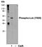 Laryngeal cancer kinase 2 antibody, MA5-28017, Invitrogen Antibodies, Western Blot image 