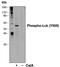 Intestinal Cell Kinase antibody, MA5-28017, Invitrogen Antibodies, Western Blot image 