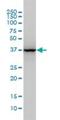 Aldolase, Fructose-Bisphosphate A antibody, H00000226-M02, Novus Biologicals, Western Blot image 