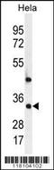 RNA polymerase transcriptional regulation mediator subunit 7 homolog antibody, 56-144, ProSci, Western Blot image 